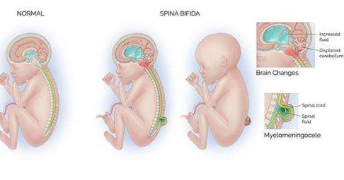 Stanfordchildrens.org